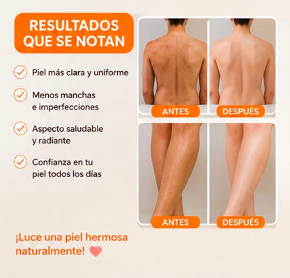Jabón de Zanahoria Aclarante 200g | Piel Luminosa y Sin Manchas – Resultados en 7 Días